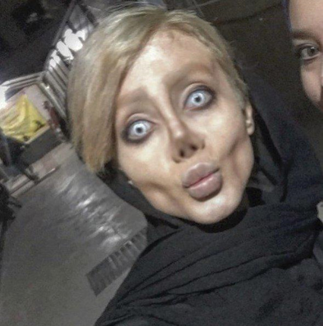 Cerrahi operasyon değil makyajla yapıyormuş