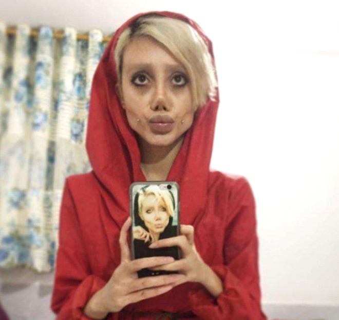 Cerrahi operasyon değil makyajla yapıyormuş