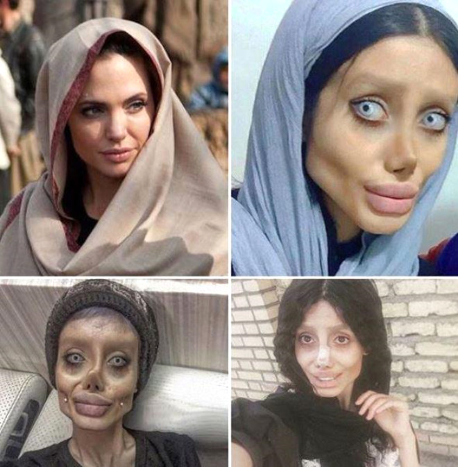 Cerrahi operasyon değil makyajla yapıyormuş