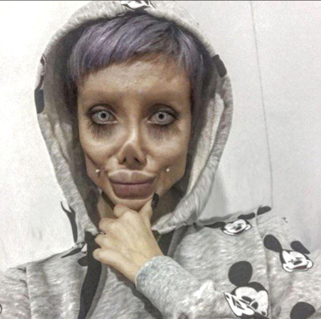 Cerrahi operasyon değil makyajla yapıyormuş