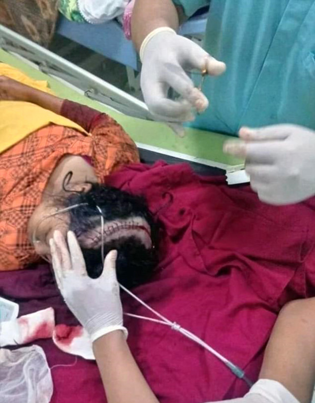 Tren yolunda selfie facia ile sonuçlandı!