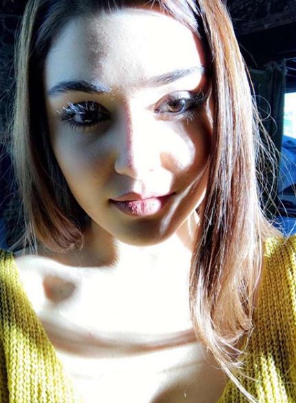 Hande Erçel’in yüzüne ne oldu?