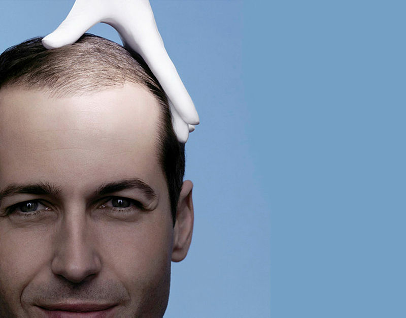 Kelliğe çare oluyor!