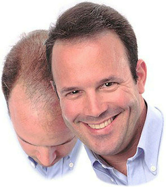 Kelliğe çare oluyor!