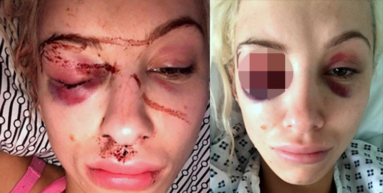 Saatlerce işkence gördü; o selfie sayesinde hayatta kaldı!