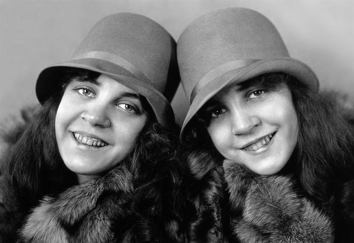 Birlikte doğup birlikte öldüler! Onların hikayesi...