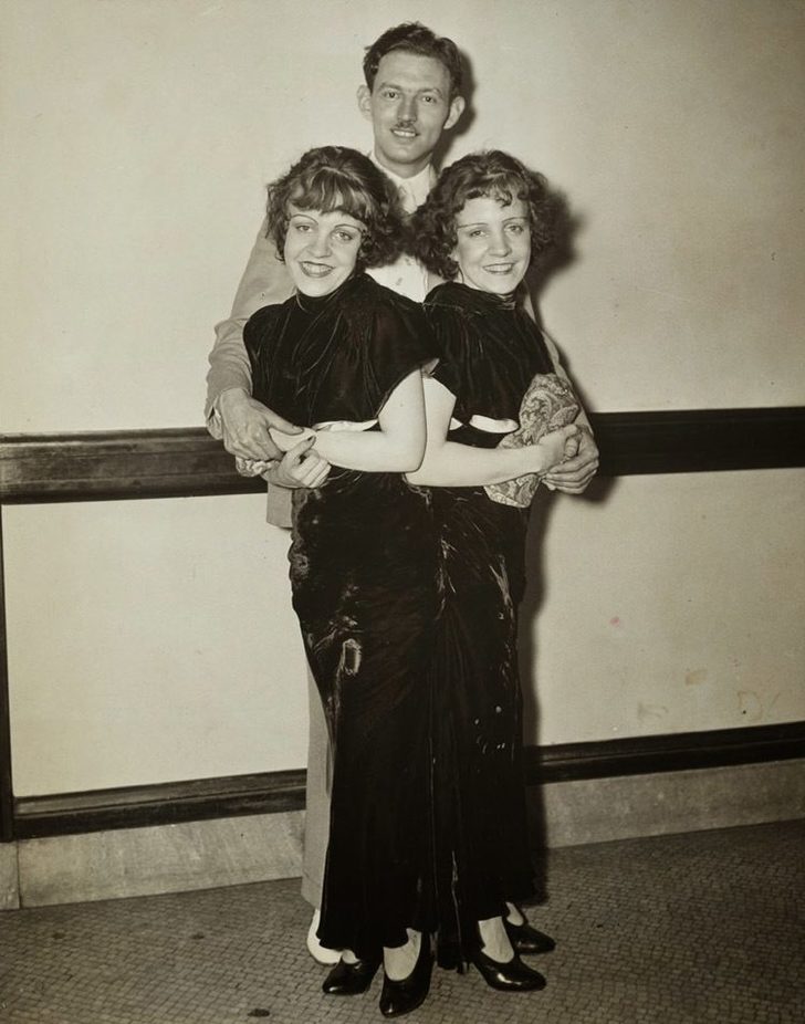 Birlikte doğup birlikte öldüler! Onların hikayesi...