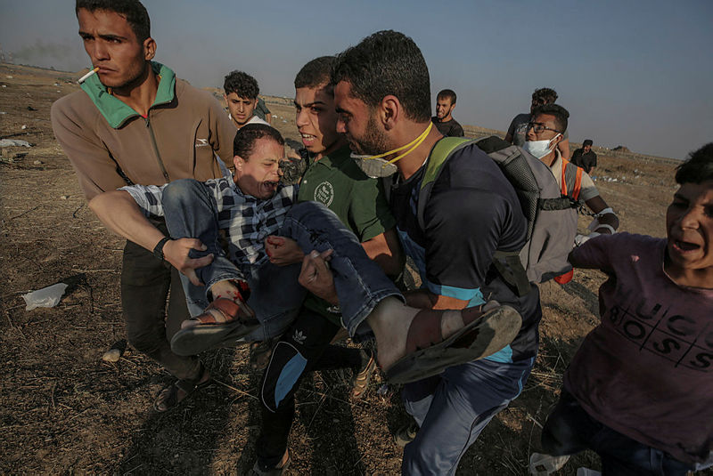 Ağzına gaz bombası isabet eden Filistinli’nin sağlık durumu belli oldu