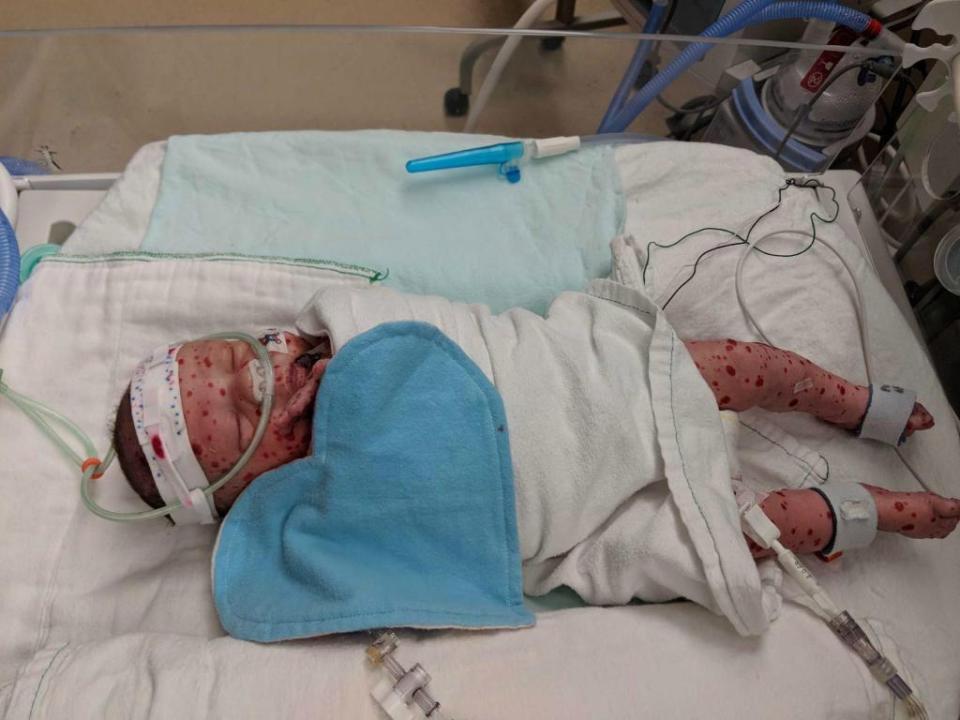 Beyninde ’saatli bomba’ ile doğdu... Şimdi ise...