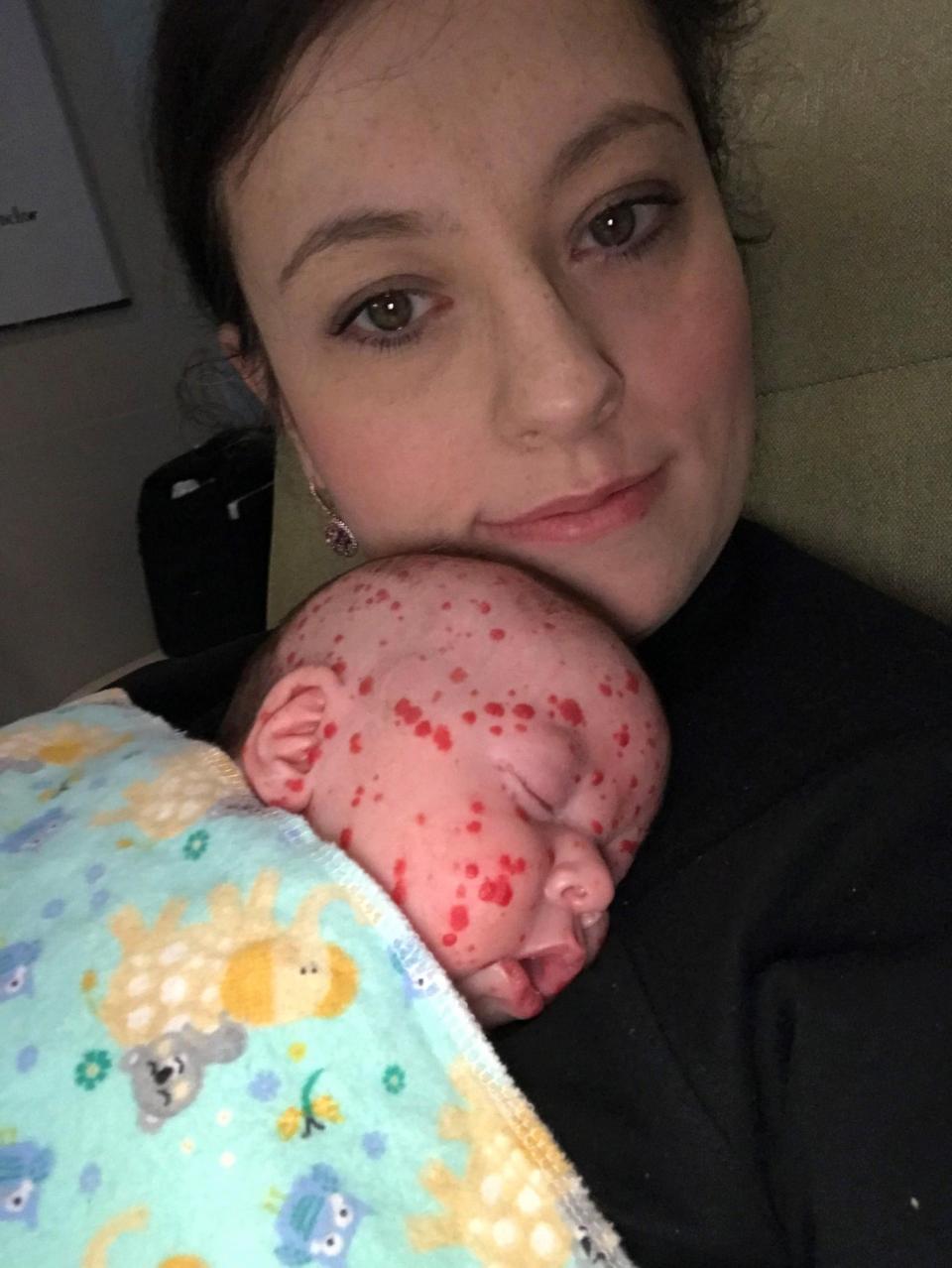 Beyninde ’saatli bomba’ ile doğdu... Şimdi ise...