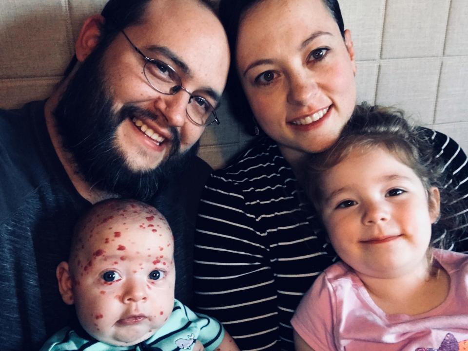 Beyninde ’saatli bomba’ ile doğdu... Şimdi ise...