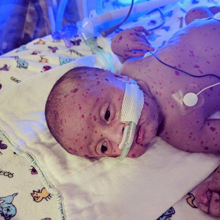 Beyninde ’saatli bomba’ ile doğdu... Şimdi ise...