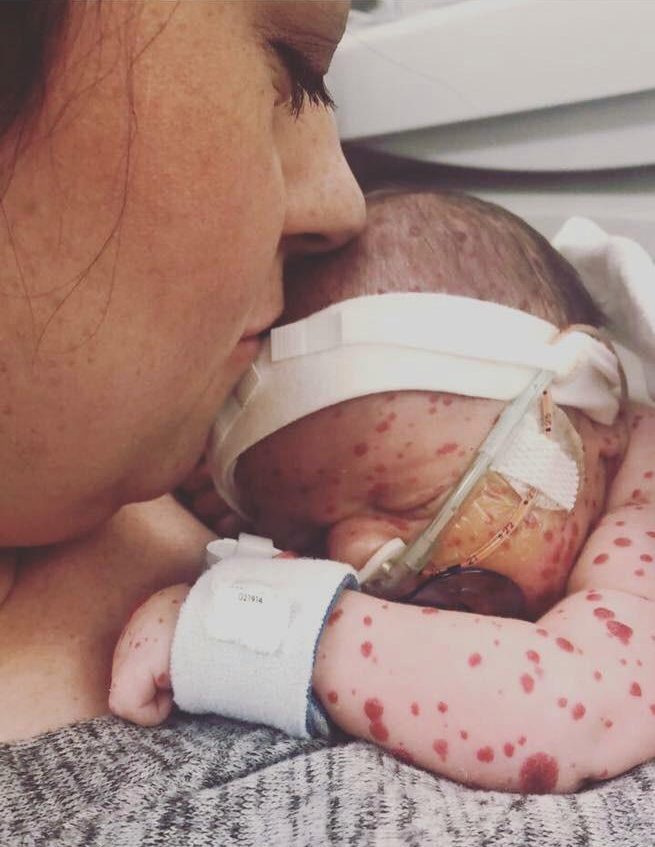 Beyninde ’saatli bomba’ ile doğdu... Şimdi ise...