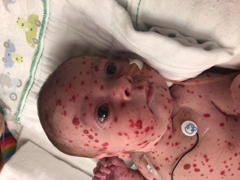 Beyninde ’saatli bomba’ ile doğdu... Şimdi ise...