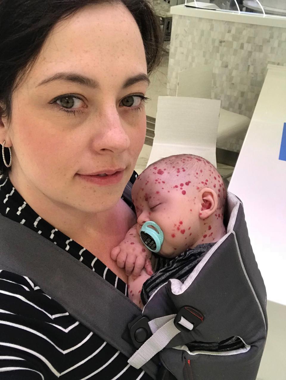 Beyninde ’saatli bomba’ ile doğdu... Şimdi ise...