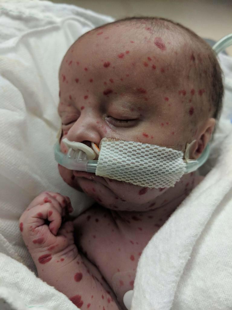 Beyninde ’saatli bomba’ ile doğdu... Şimdi ise...