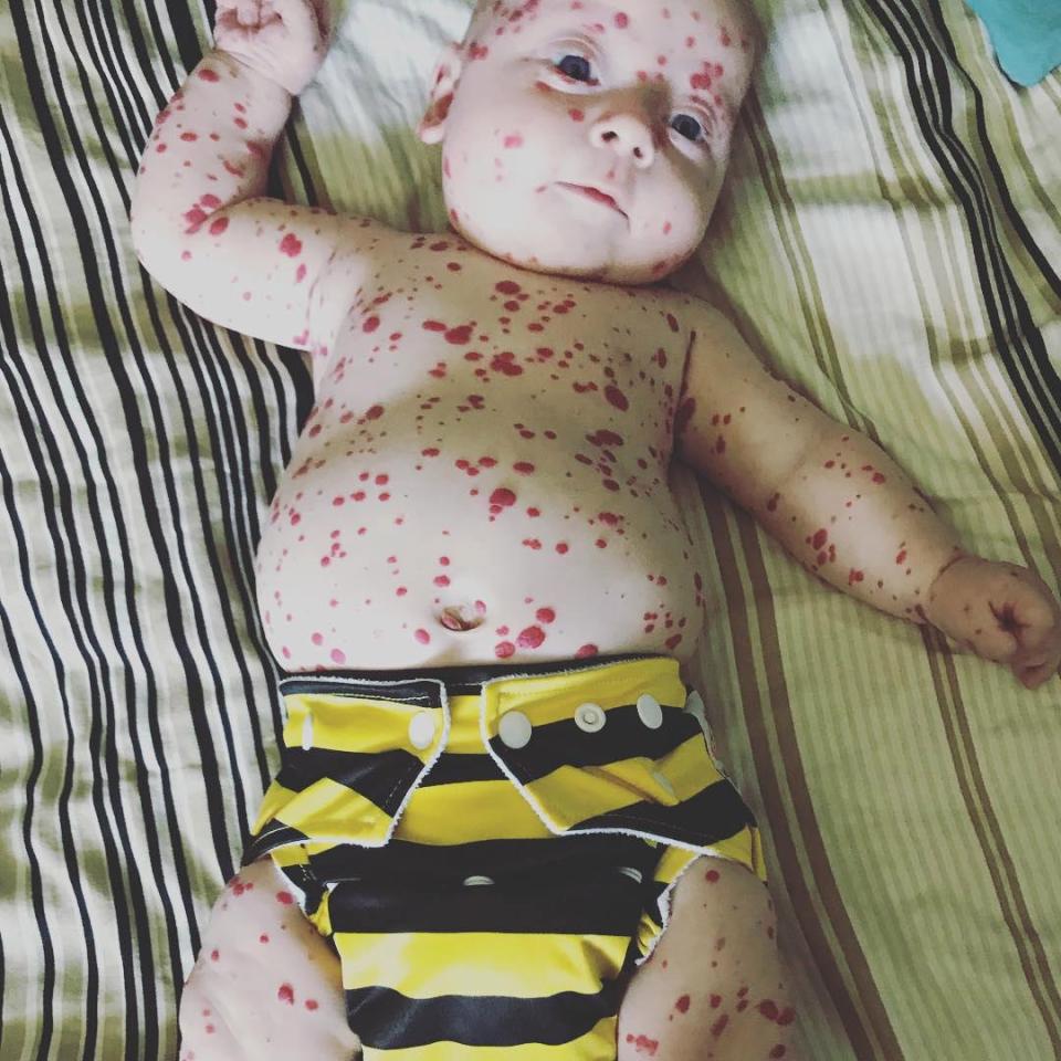 Beyninde ’saatli bomba’ ile doğdu... Şimdi ise...