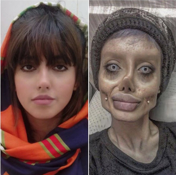 Gerçekten estetik operasyon geçirdi: İşte son hali