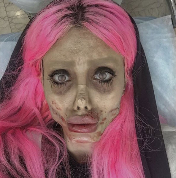 Gerçekten estetik operasyon geçirdi: İşte son hali