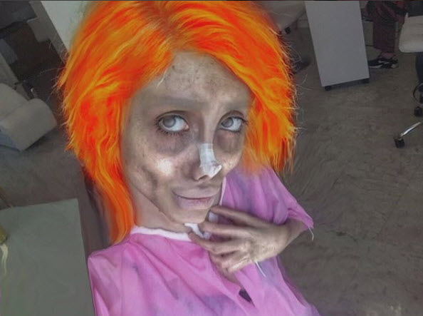 Gerçekten estetik operasyon geçirdi: İşte son hali