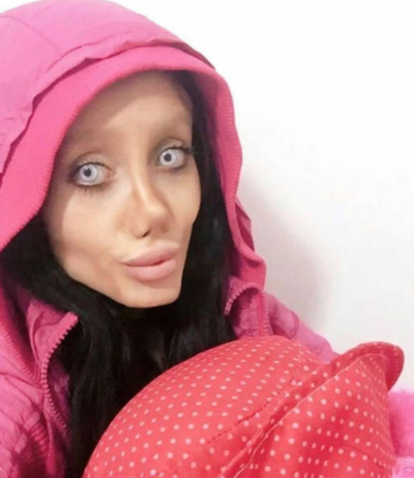 Gerçekten estetik operasyon geçirdi: İşte son hali