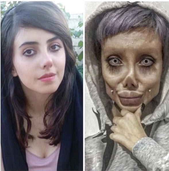 Gerçekten estetik operasyon geçirdi: İşte son hali