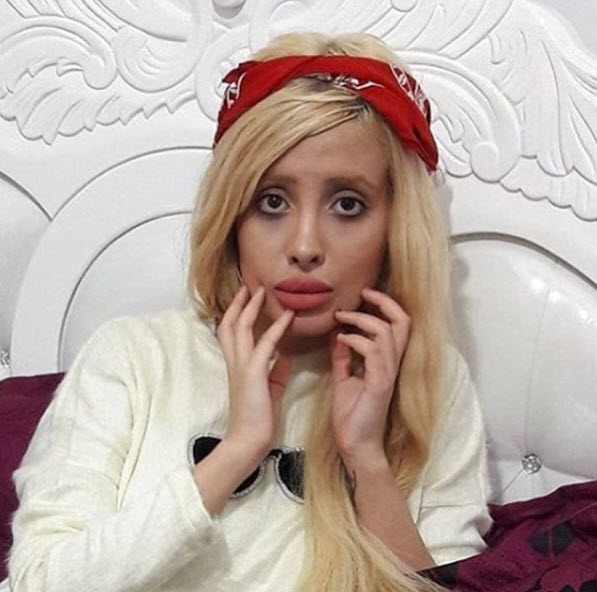 Gerçekten estetik operasyon geçirdi: İşte son hali