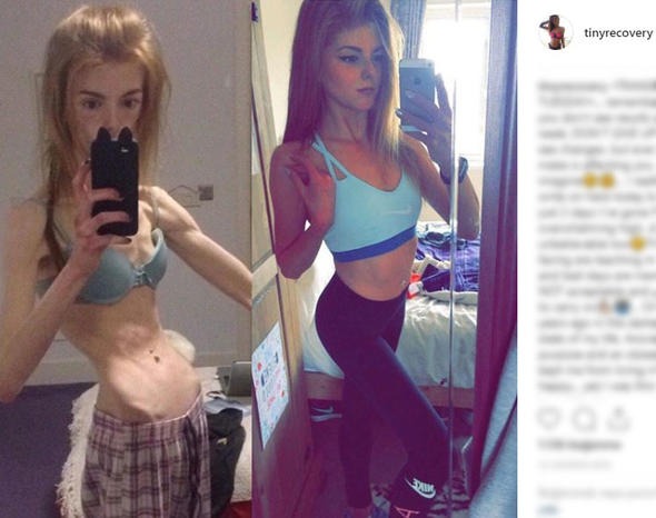 28 kiloya kadar düşmüştü! Bu durumdan kurtulmasını sağlayan yiyecek ise...