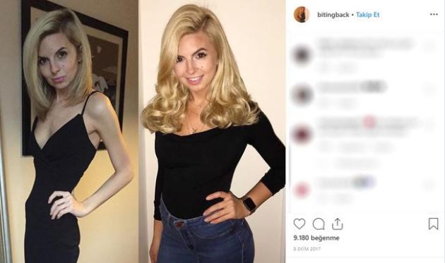 38 kiloya kadar düşmüştü! Son hali herkesi şaşırtıyor