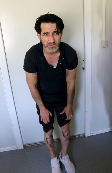 Yunanistan’da göçmen zulmü devam ediyor! Bu kez de plastik mermi ve şok cihazı...