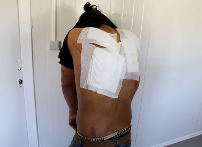 Yunanistan’da göçmen zulmü devam ediyor! Bu kez de plastik mermi ve şok cihazı...