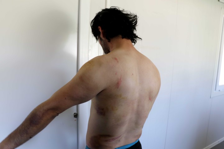 Yunanistan’da göçmen zulmü devam ediyor! Bu kez de plastik mermi ve şok cihazı...