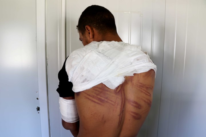 Yunanistan’da göçmen zulmü devam ediyor! Bu kez de plastik mermi ve şok cihazı...