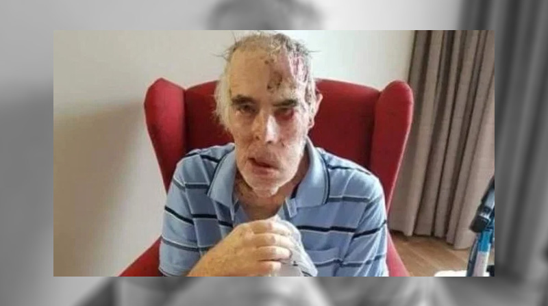 Son Dakika: O ülkeden kan donduran olay! Karısına beni bırakmayın diye yalvardı..10 gün sonra öldü!