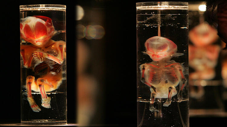 Son dakika! Öyle bir şey saklamış ki.. Ölen doktorun evinde 2 binden fazla bulundu!