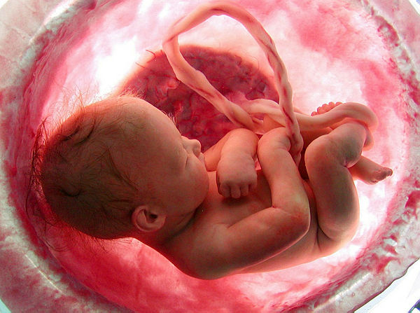 Son dakika! Öyle bir şey saklamış ki.. Ölen doktorun evinde 2 binden fazla bulundu!