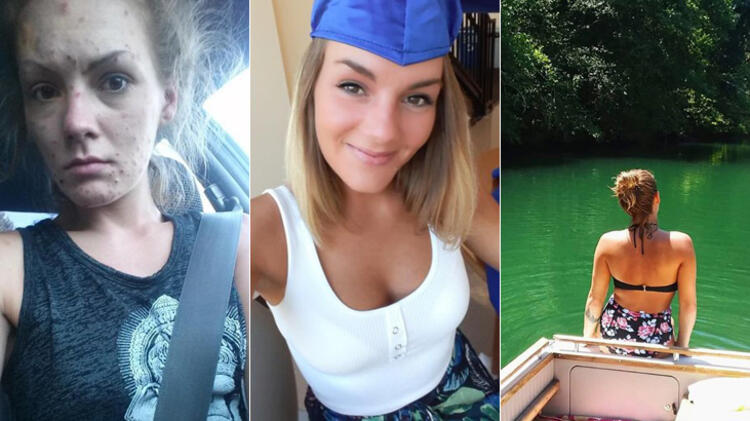 Son dakika haberi: İki yıl arayla çekilen fotoğraflar şoke etti! Hayatı kabusa döndü!