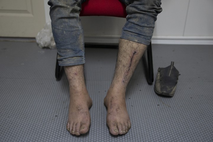 Göçmenlere Yunan işkencesi! Ellerinde sigara söndürdüler!