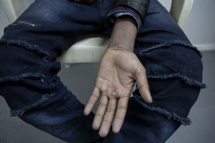 Göçmenlere Yunan işkencesi! Ellerinde sigara söndürdüler!