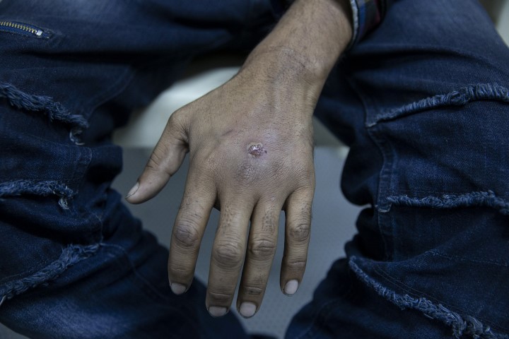 Göçmenlere Yunan işkencesi! Ellerinde sigara söndürdüler!