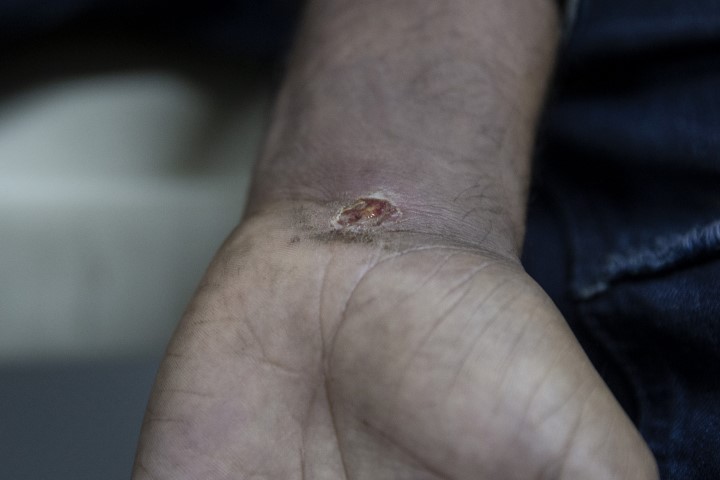 Göçmenlere Yunan işkencesi! Ellerinde sigara söndürdüler!