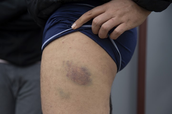 Göçmenlere Yunan işkencesi! Ellerinde sigara söndürdüler!