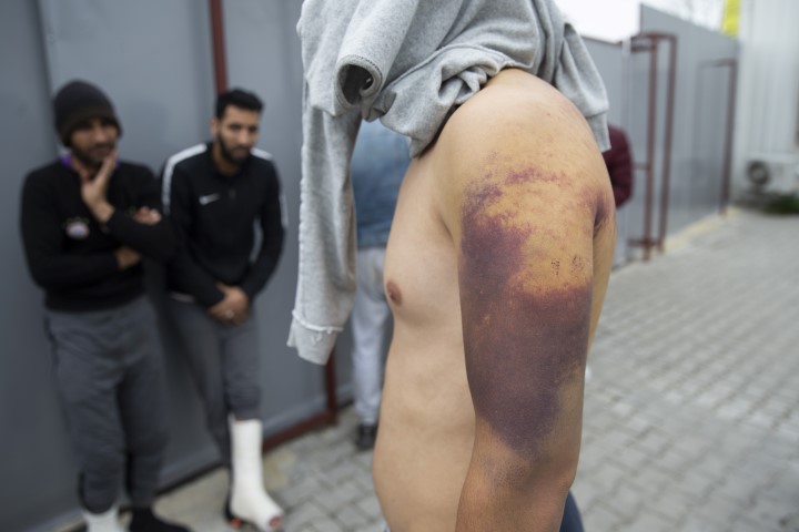 Göçmenlere Yunan işkencesi! Ellerinde sigara söndürdüler!