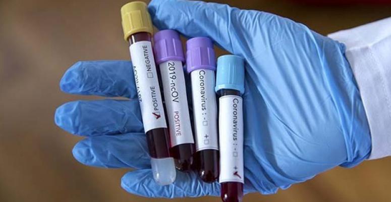 Son dakika: Ölü sayısı giderek artıyor! Corona virüsünden ölenlerin sayısı ne kadar oldu? Korona virüsten kaç kişi öldü? İşte Corona virüsünde son durum...