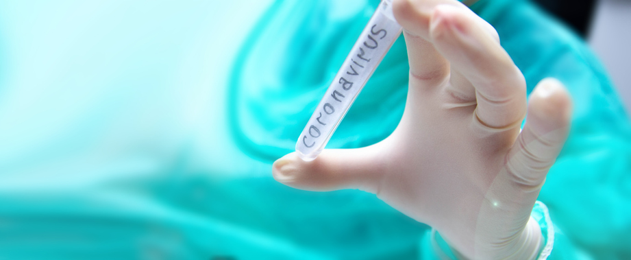 SON DAKİKA HABERİ: Koronavirüs evcil köpekte görüldü! Corona virüs salgını giderek yayılıyor!