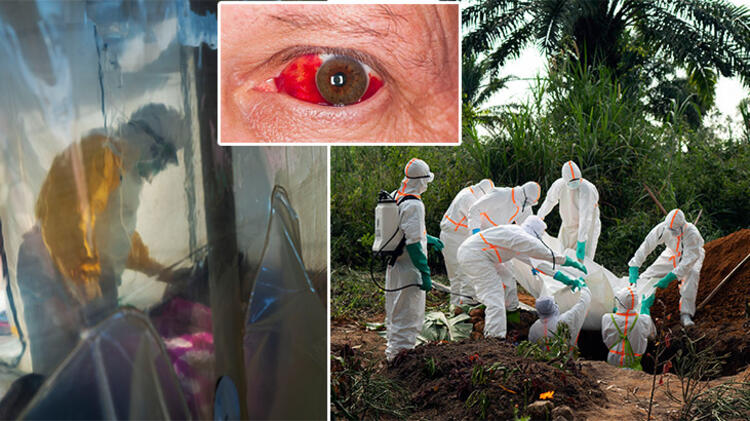 Dünya bu son dakika haberini konuşuyor: Hastalığa yakalananlar gözleri kanayarak ölüyor! DSÖ kırmızı alarm verdi, çalışmalar başladı
