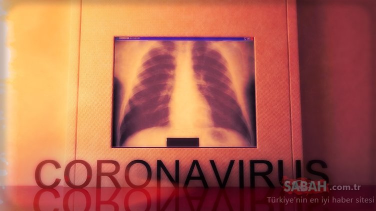 Corona virüsü belirtileri nelerdir, kaç gün sürer? Kovid-19 Korona virüs belirtileri nasıl anlaşılır?