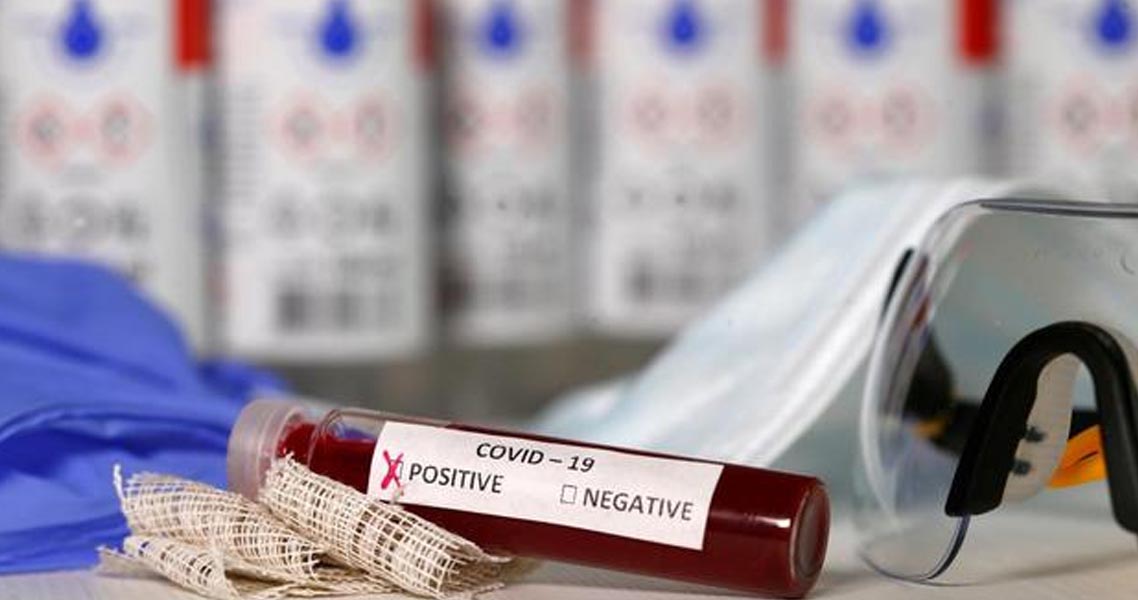 SON DAKİKA! Corona virüsü anketinden çarpıcı sonuçlar çıktı! İşte halkın en güvendiği kaynak...