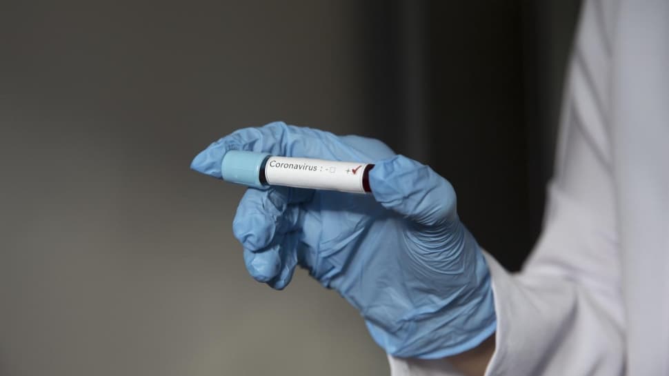 Son dakika haberi: Corona virüsün iki yeni hayati belirtisi ortaya çıktı! Uzman isimden gençlere önemli uyarı