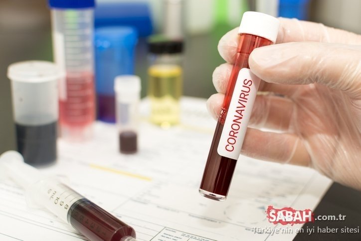 Uzmanlardan Corona virüs belirtileri ile ilgili şoke eden son dakika haberi: Corona virüsü belirtileri vakaların yüzde 40’ı…